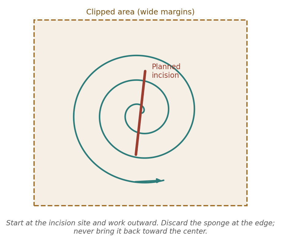 The concentric scrub pattern. Each pass moves contaminants away from the planned incision.
