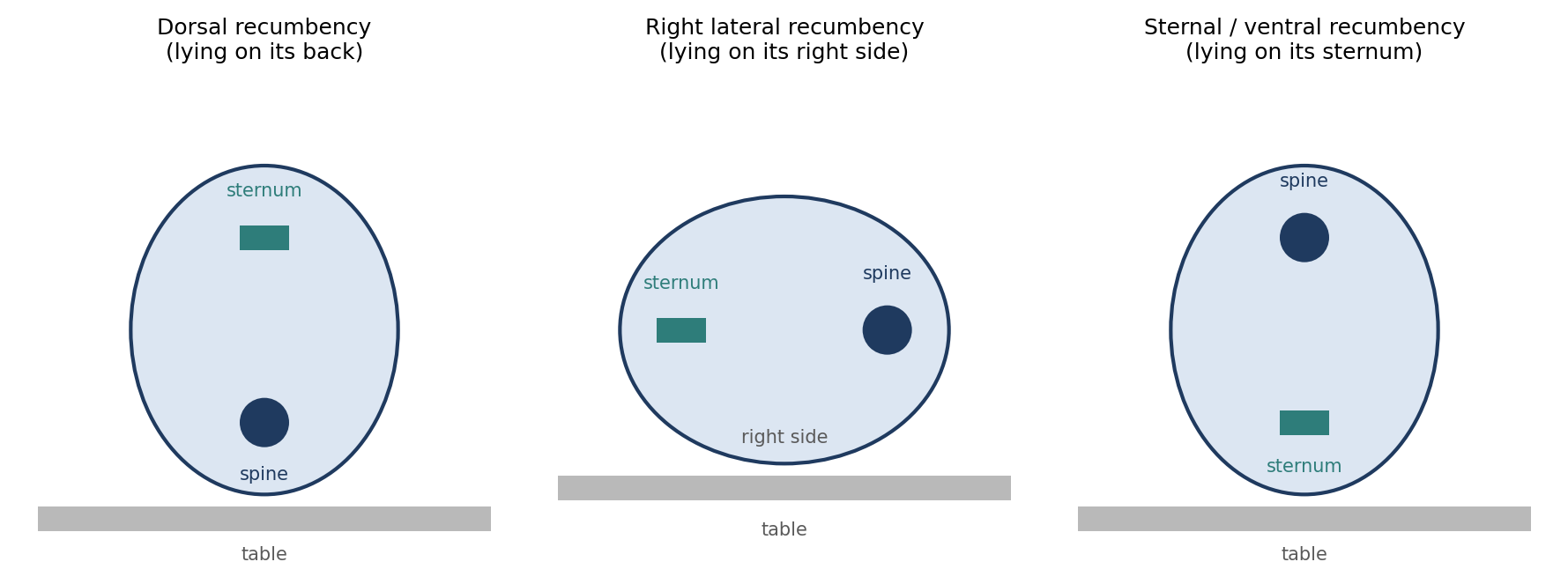 Common surgical positions, shown as cross-sections of the trunk. Each is named for the surface in contact with the table.