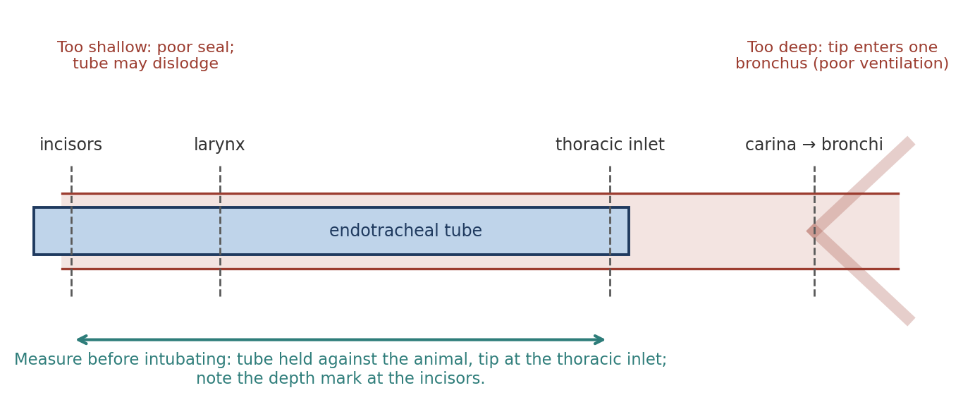 Measuring endotracheal tube depth. The tip should lie at about the thoracic inlet, above the carina.