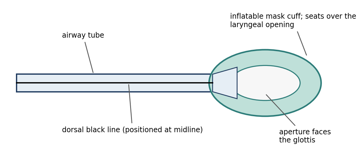 Basic structure of a laryngeal mask airway.