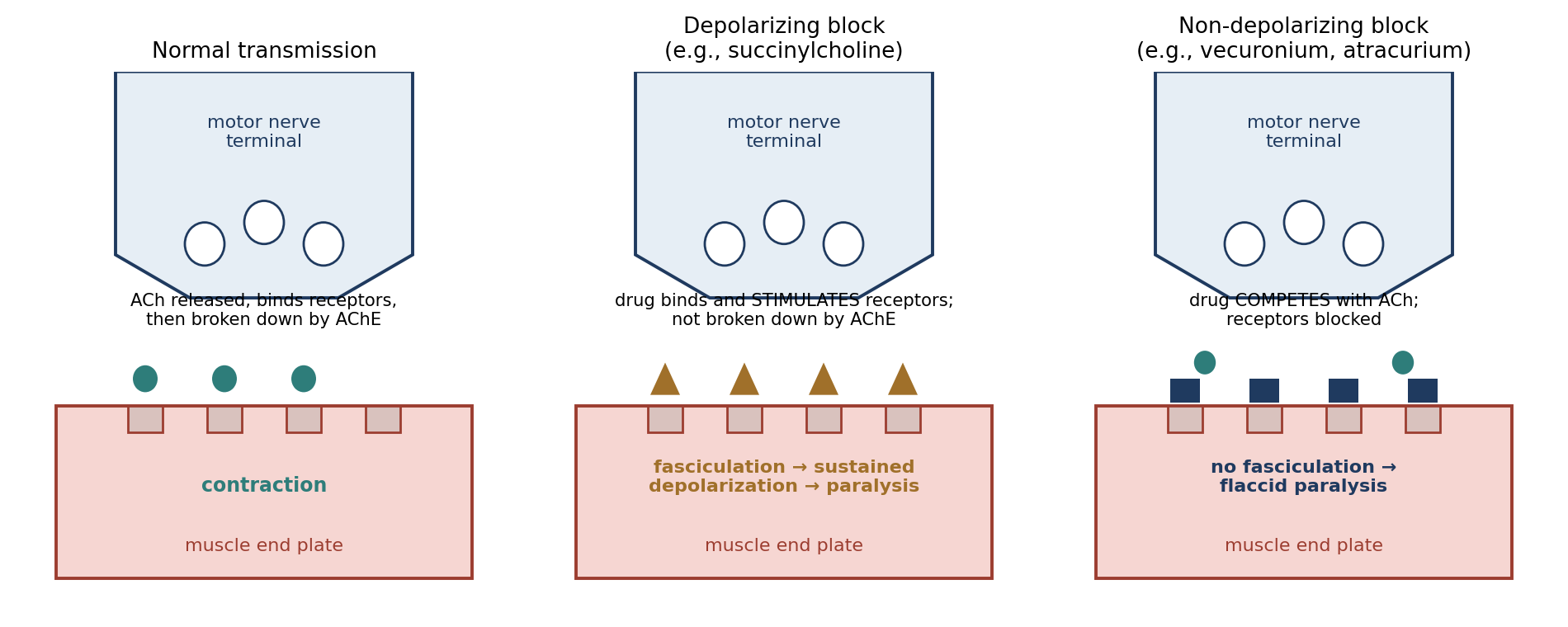 Normal neuromuscular transmission compared with depolarizing and non-depolarizing neuromuscular block. ACh, acetylcholine; AChE, acetylcholinesterase.
