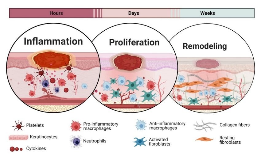 The inflammation, proliferation, and remodeling phases, and the key cells involved in each.