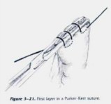 Parker-Kerr: first (Cushing) layer