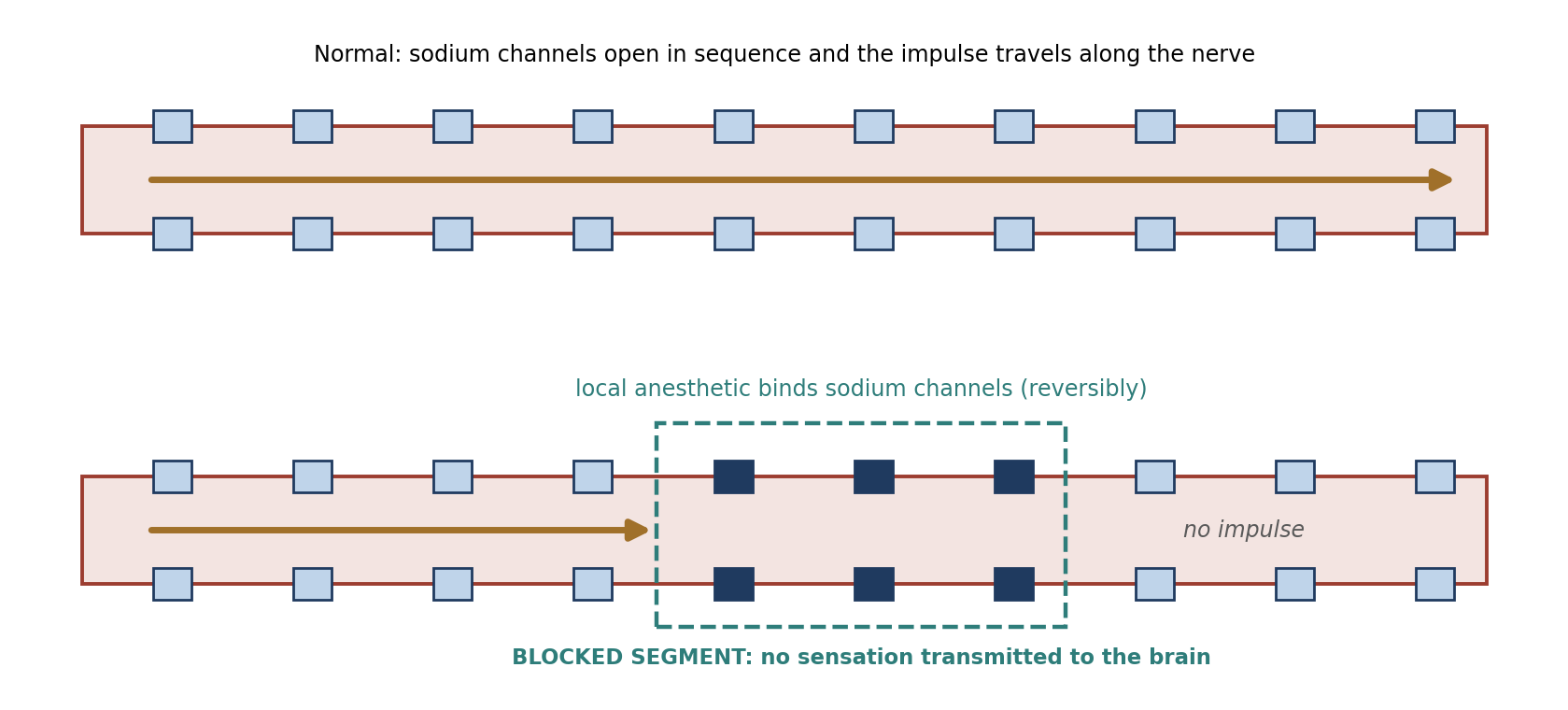 Local anesthetics reversibly bind sodium channels, preventing impulse conduction through the blocked segment of nerve.