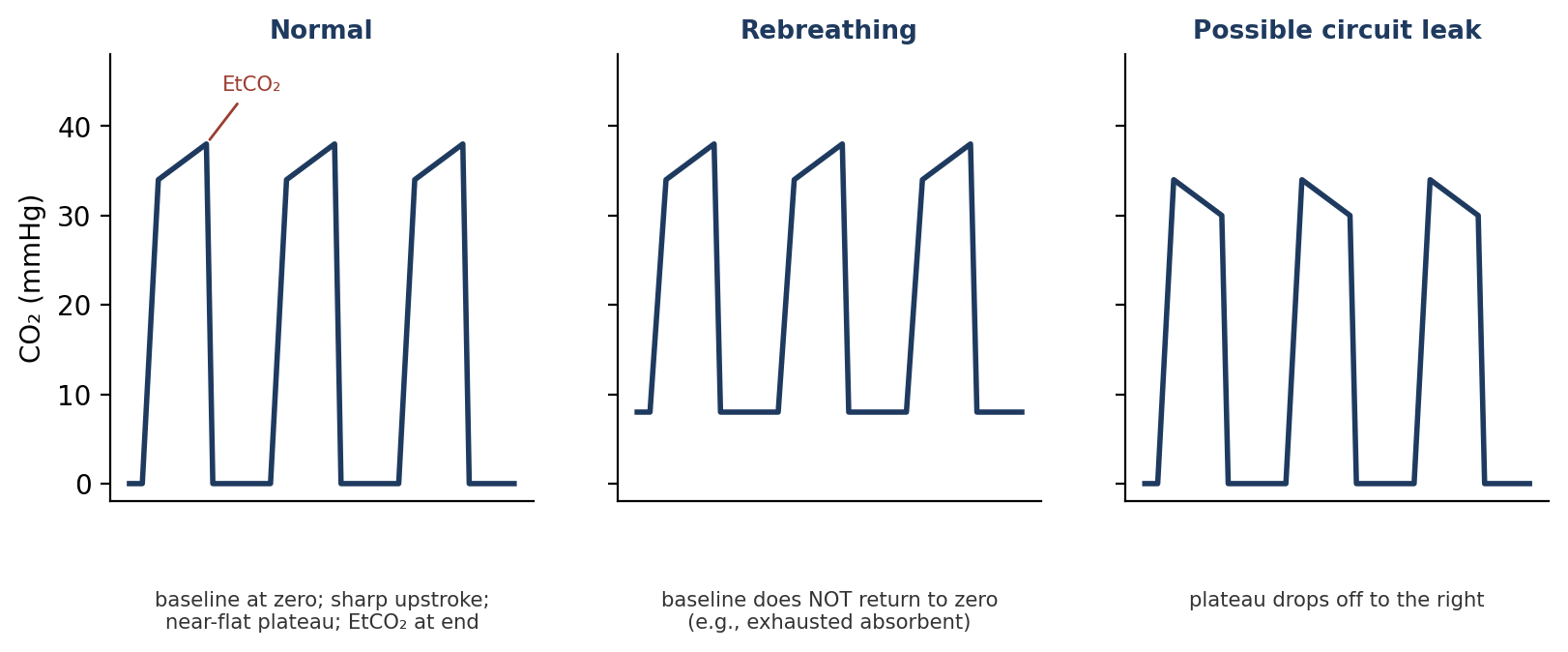 Capnogram waveforms: normal, rebreathing, and a pattern that may indicate a circuit leak (schematic).