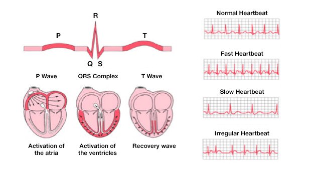 How the ECG waves correspond to electrical activation of the heart: the P wave (atria), QRS complex (ventricles), and T wave (recovery).
